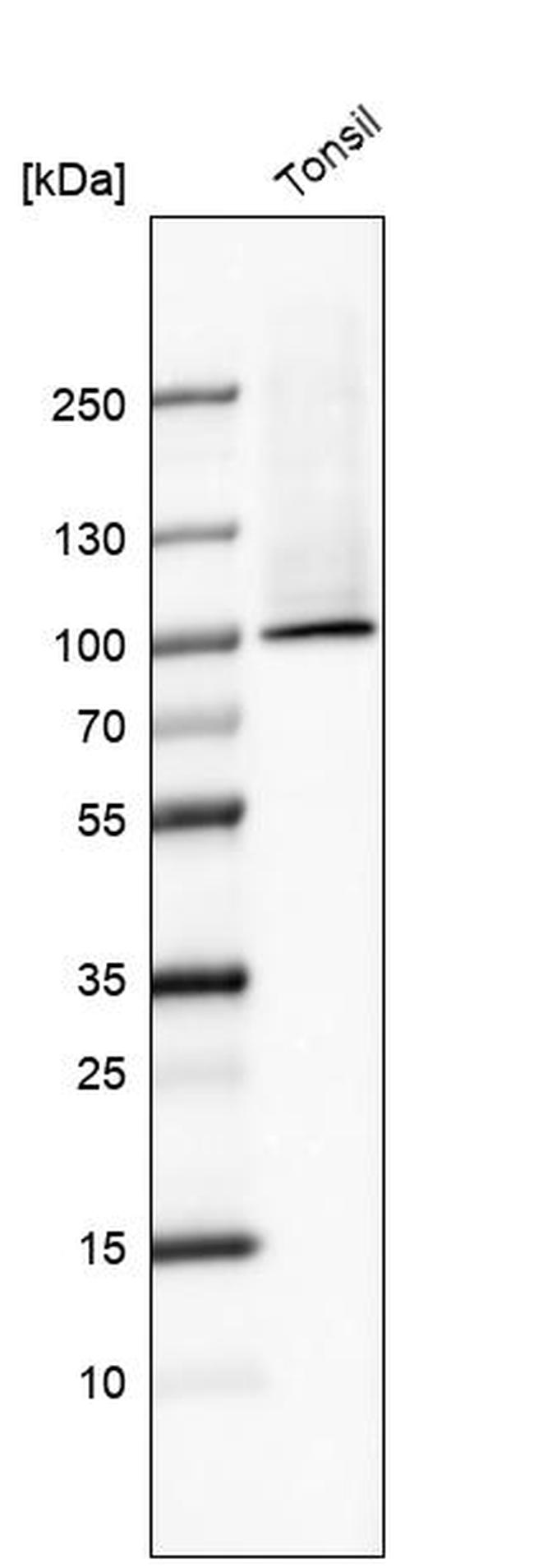 TGM1 Antibody in Western Blot (WB)