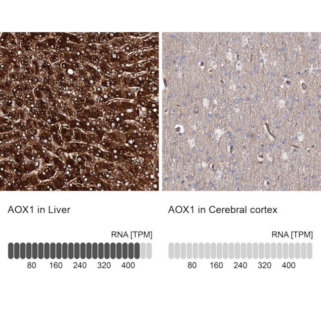 AOX1 Antibody in Immunohistochemistry (IHC)