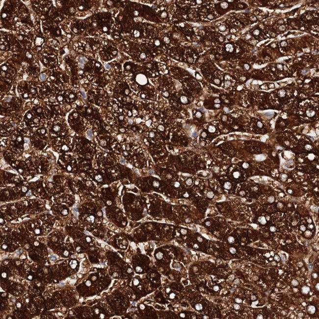 AOX1 Antibody in Immunohistochemistry (IHC)