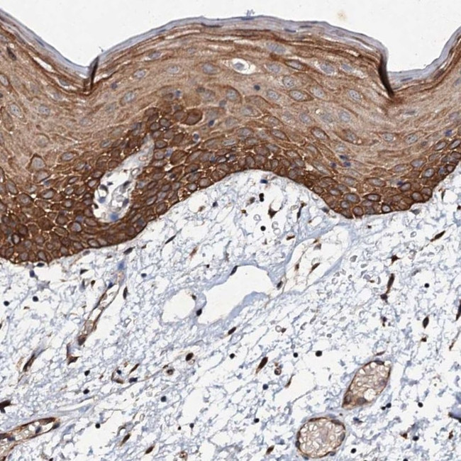 ADAMTS10 Antibody in Immunohistochemistry (IHC)