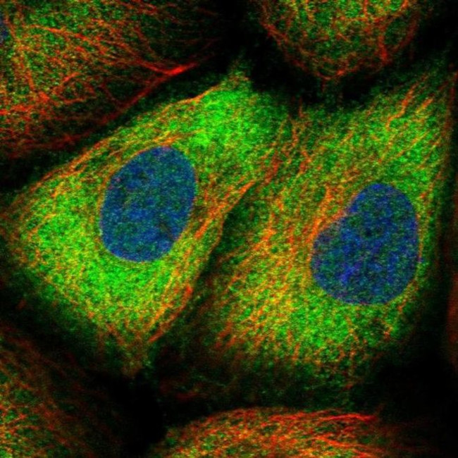 Sorbitol Dehydrogenase Antibody in Immunocytochemistry (ICC/IF)