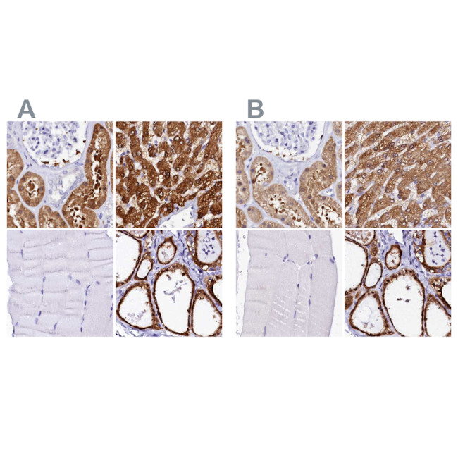 Sorbitol Dehydrogenase Antibody in Immunohistochemistry (IHC)