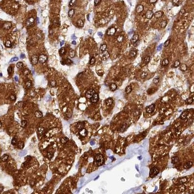 Sorbitol Dehydrogenase Antibody in Immunohistochemistry (IHC)