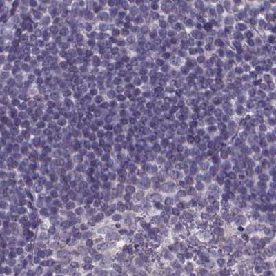 SPEF2 Antibody in Immunohistochemistry (IHC)