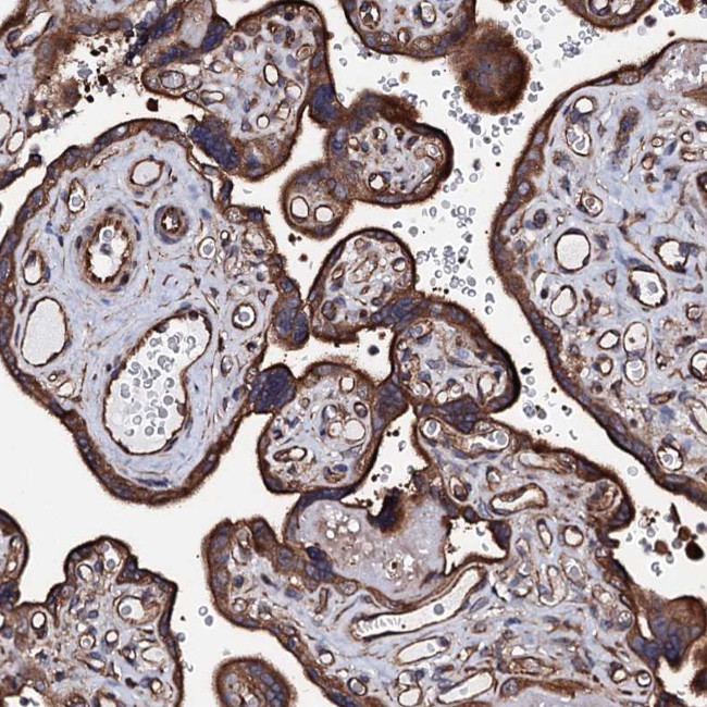 CKAP5 Antibody in Immunohistochemistry (IHC)