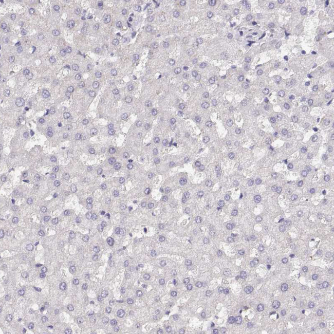 NUTM1 Antibody in Immunohistochemistry (IHC)