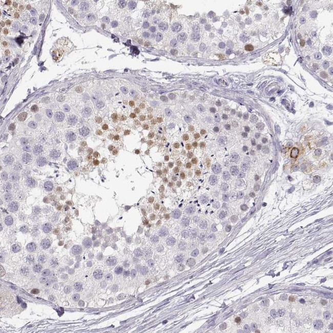 NUTM1 Antibody in Immunohistochemistry (IHC)