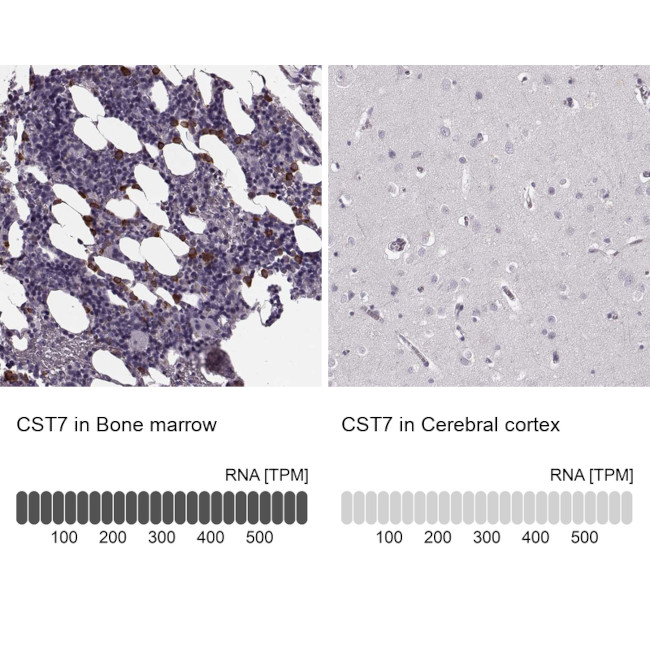 Cystatin F Antibody in Immunohistochemistry (IHC)