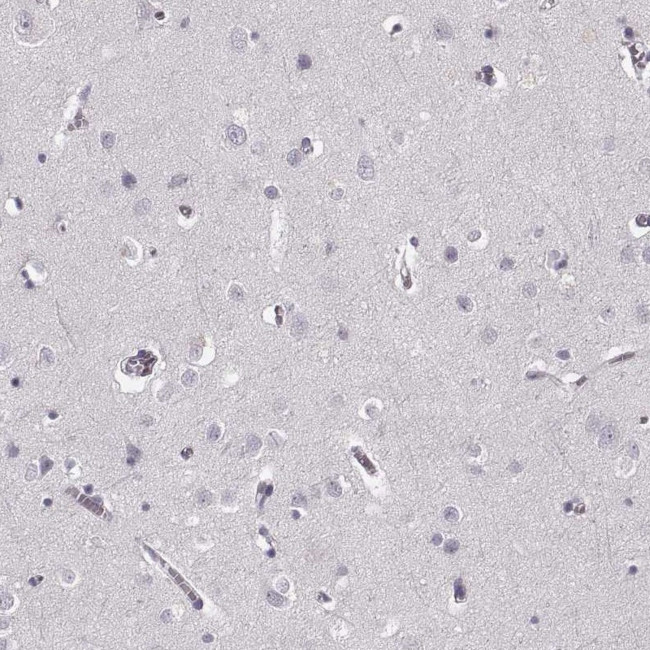 Cystatin F Antibody in Immunohistochemistry (IHC)