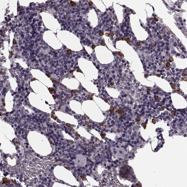 Cystatin F Antibody in Immunohistochemistry (IHC)