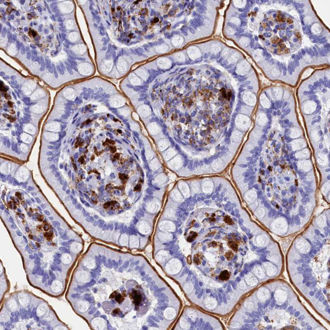 PLAC8 Antibody in Immunohistochemistry (IHC)