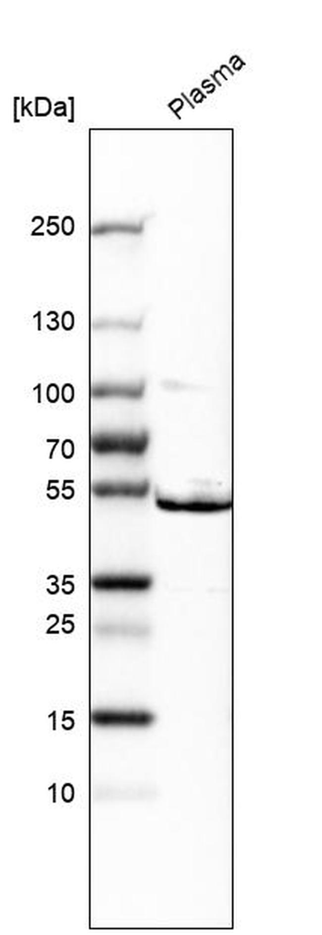 ST3GAL1 Antibody in Western Blot (WB)