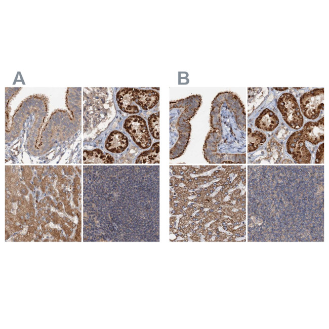 CEP68 Antibody in Immunohistochemistry (IHC)