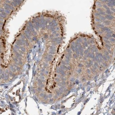 CEP68 Antibody in Immunohistochemistry (IHC)