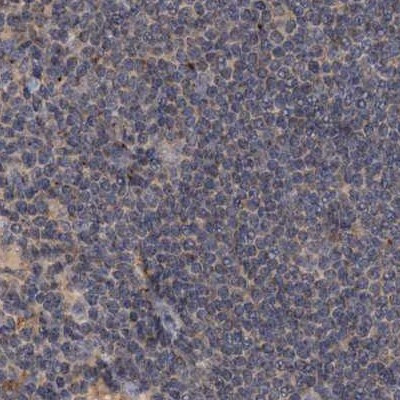 CEP68 Antibody in Immunohistochemistry (IHC)