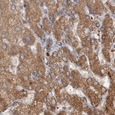 CEP68 Antibody in Immunohistochemistry (IHC)