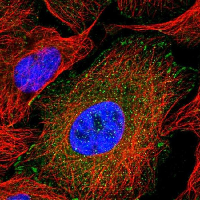 Kindlin 2 Antibody in Immunocytochemistry (ICC/IF)