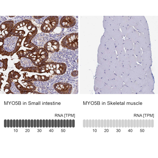 MYO5B Antibody in Immunohistochemistry (IHC)