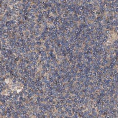 CEP68 Antibody in Immunohistochemistry (IHC)