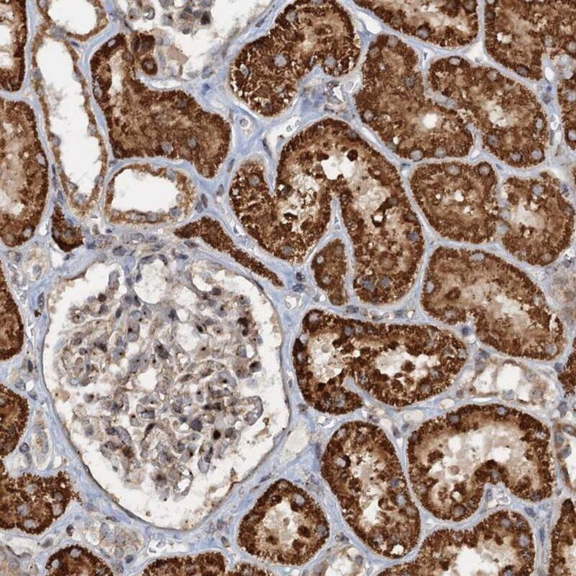 CEP68 Antibody in Immunohistochemistry (IHC)