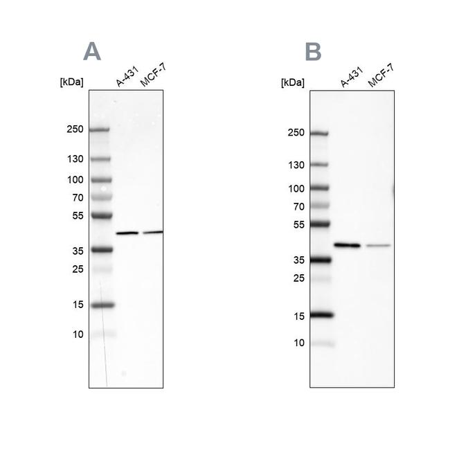 Sorbitol Dehydrogenase Antibody in Western Blot (WB)