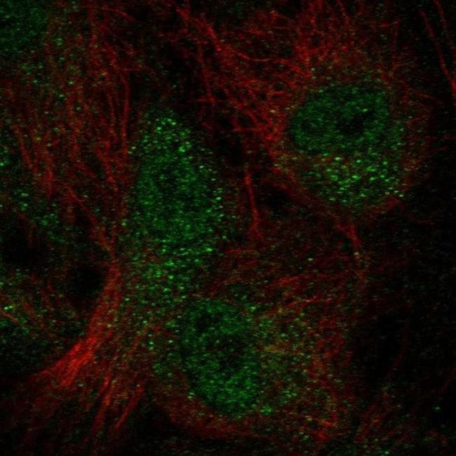 WDFY4 Antibody in Immunocytochemistry (ICC/IF)