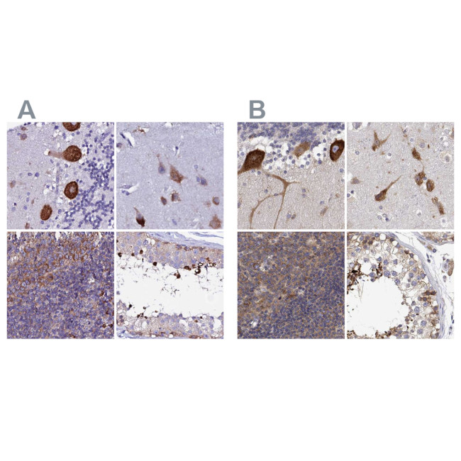 EEF1G Antibody in Immunohistochemistry (IHC)