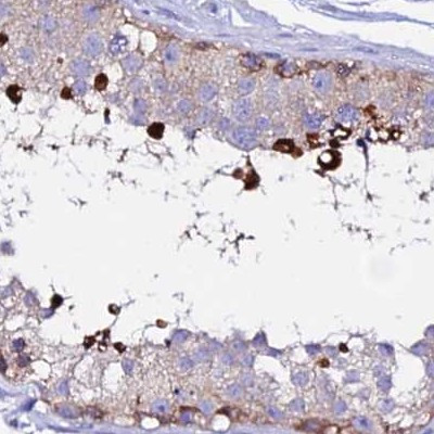 EEF1G Antibody in Immunohistochemistry (IHC)