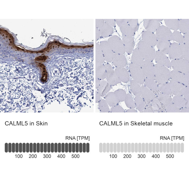 CALML5 Antibody in Immunohistochemistry (IHC)