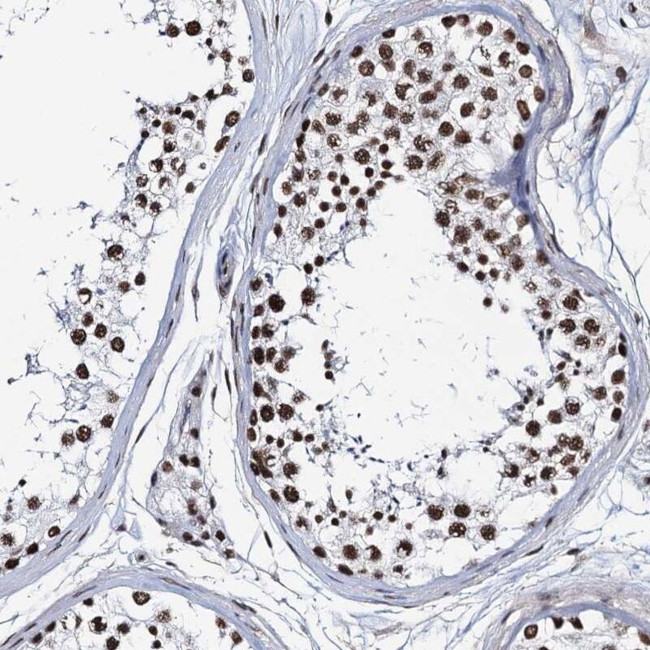 ZNF609 Antibody in Immunohistochemistry (IHC)