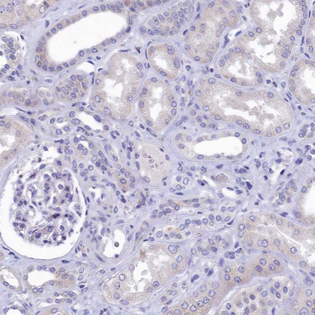 GIF Antibody in Immunohistochemistry (IHC)