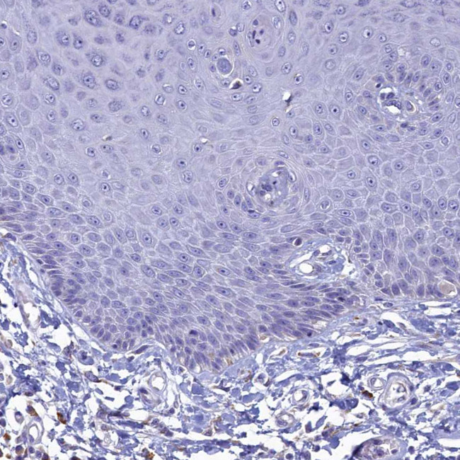 GIF Antibody in Immunohistochemistry (IHC)