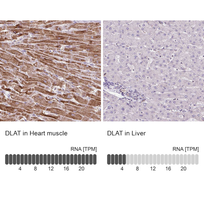 DLAT Antibody in Immunohistochemistry (IHC)