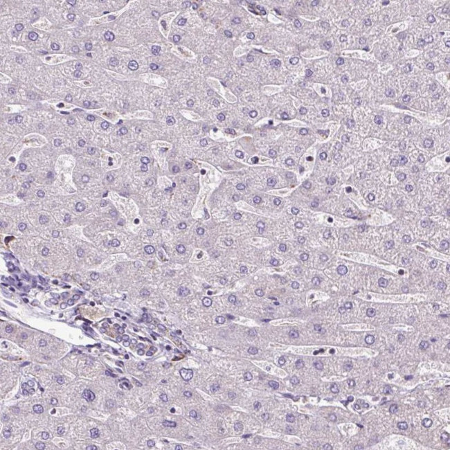 DLAT Antibody in Immunohistochemistry (IHC)