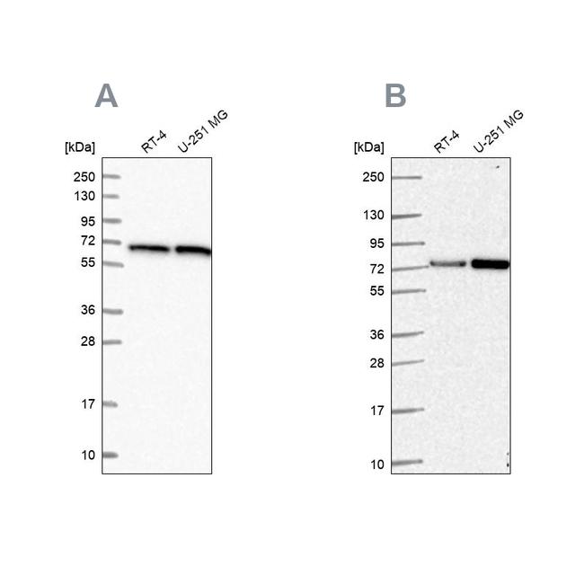 DLAT Antibody in Western Blot (WB)