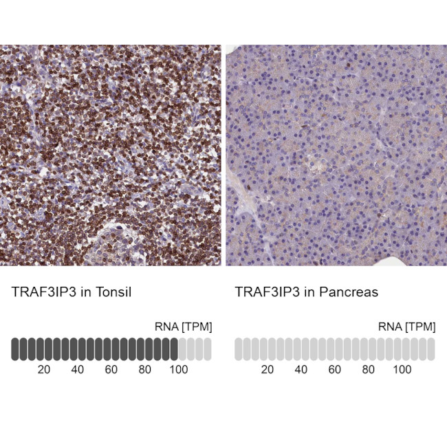 TRAF3IP3 Antibody in Immunohistochemistry (IHC)