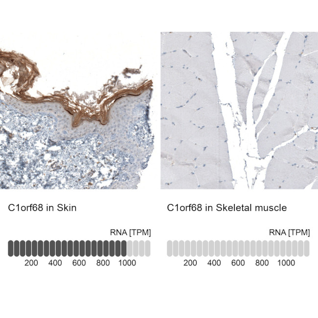 XP32 Antibody in Immunohistochemistry (IHC)