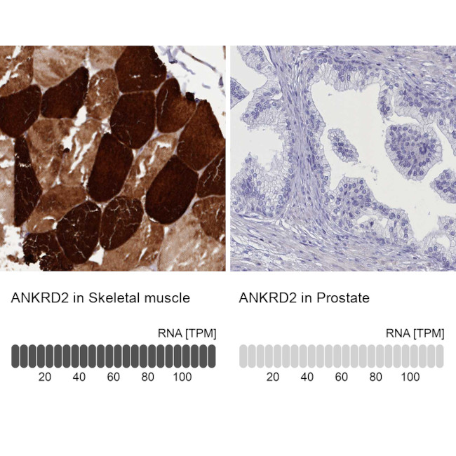 ANKRD2 Antibody in Immunohistochemistry (IHC)