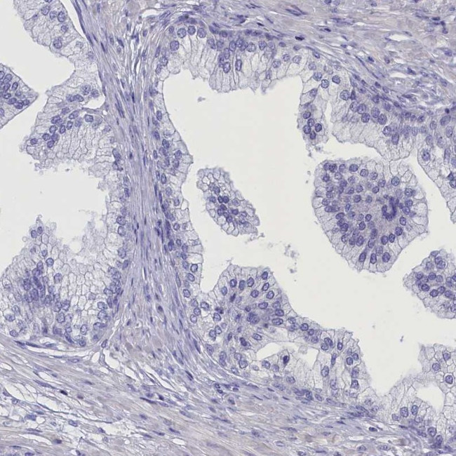 ANKRD2 Antibody in Immunohistochemistry (IHC)