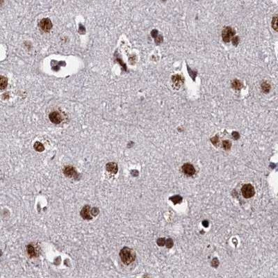 ZC3H18 Antibody in Immunohistochemistry (IHC)