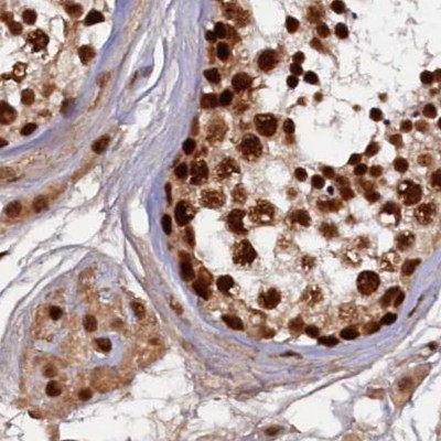 ZC3H18 Antibody in Immunohistochemistry (IHC)