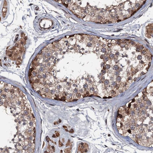 N4BP1 Antibody in Immunohistochemistry (IHC)