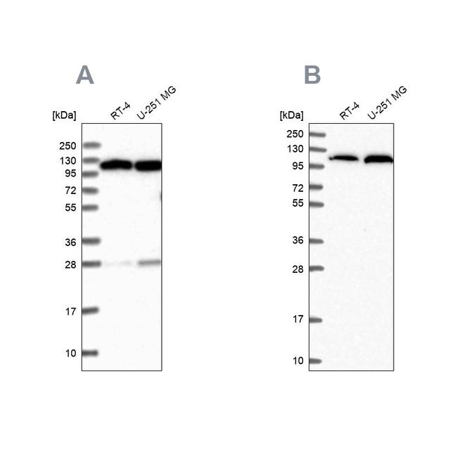 alanyl-tRNA Synthetase Antibody in Western Blot (WB)