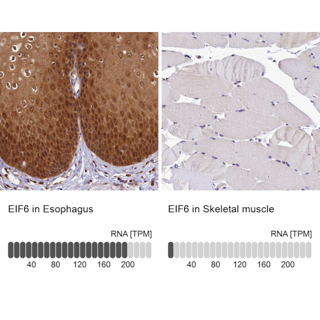 eIF6 Antibody in Immunohistochemistry (IHC)