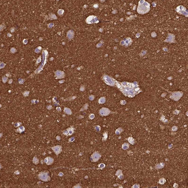 GNAO1 Antibody in Immunohistochemistry (IHC)