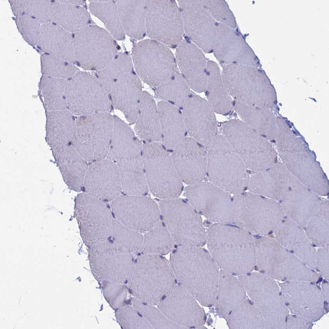 MYO5B Antibody in Immunohistochemistry (IHC)