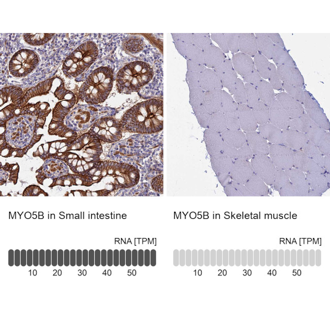 MYO5B Antibody