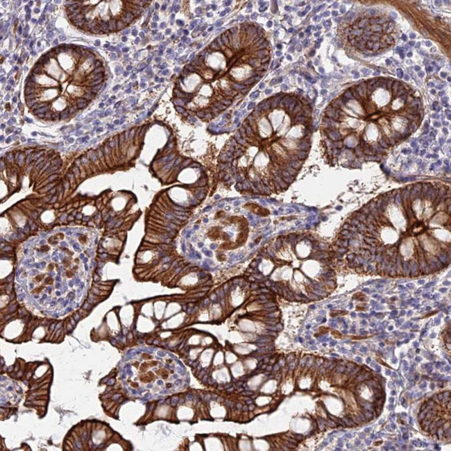 MYO5B Antibody in Immunohistochemistry (IHC)