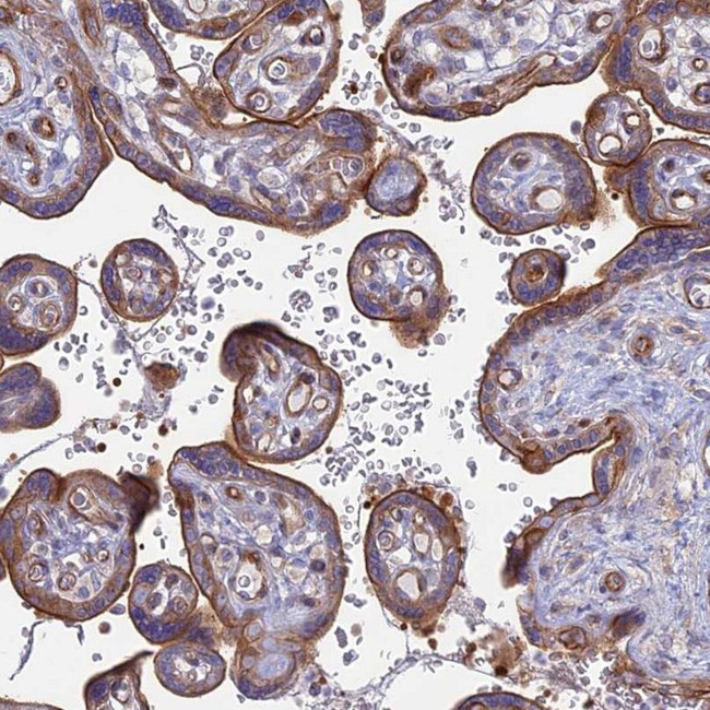 MYO5B Antibody in Immunohistochemistry (IHC)