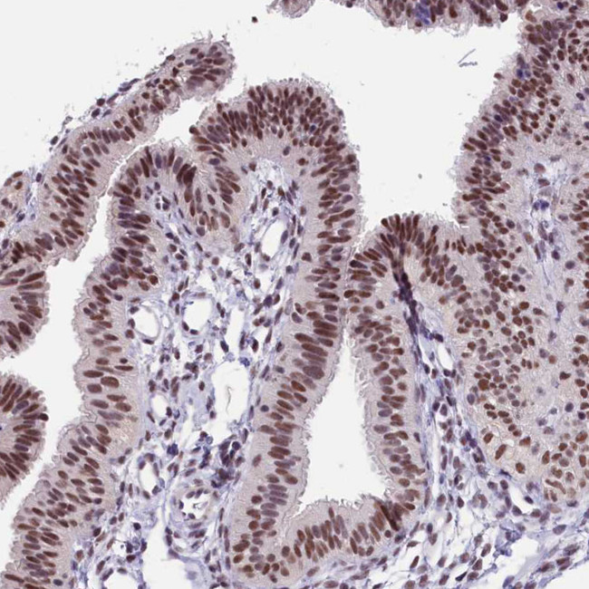 ZC3H4 Antibody in Immunohistochemistry (IHC)